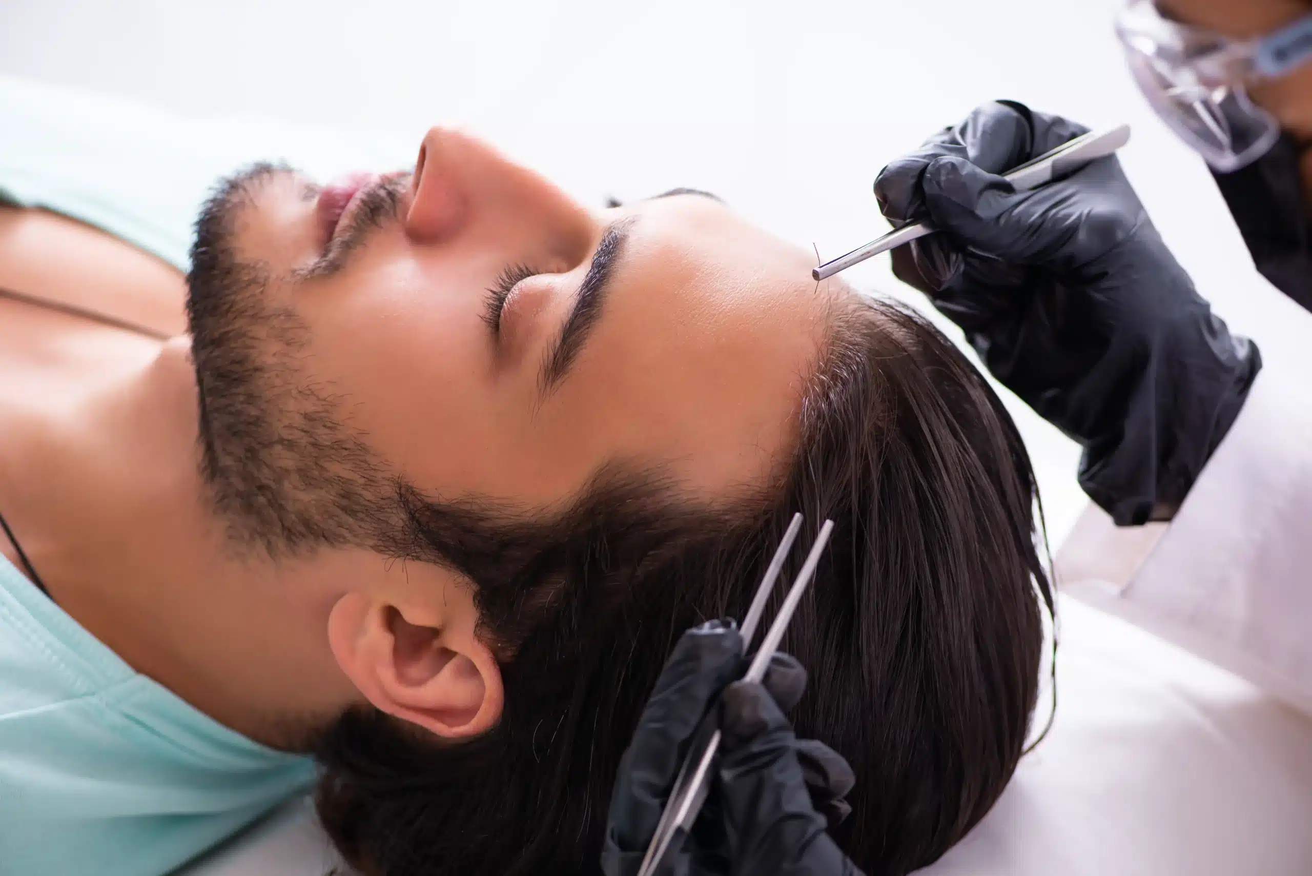 Hair transplant without scarring